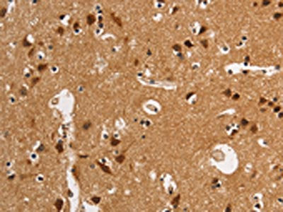 The image on the left is immunohistochemistry of paraffin-embedded Human brain  tissue using ANAPC4 Antibody(ANAPC4 Antibody) at dilution 1/50, on the right is treated with synthetic peptide. (Original magnification: ×200)Rabbit anti-Human ANAPC4 Polyclonal Antibody