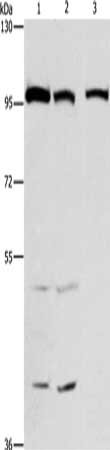 Gel: 6%SDS-PAGE, Lysate: 40 μg, Lane 1-3: HepG2 cells, 231 cells, hela cells, Primary antibody: ANAPC4 Antibody(ANAPC4 Antibody) at dilution 1/300, Secondary antibody: Goat anti rabbit IgG at 1/8000 dilution, Exposure time: 1 minuteRabbit anti-Human ANAPC4 Polyclonal Antibody
