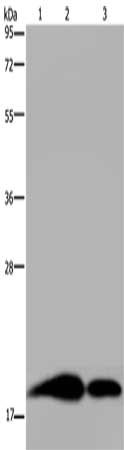 Gel: 10%SDS-PAGE, Lysate: 40 μg, Lane 1-3: Human brain malignant glioma tissue, mouse kidney tissue, human kidney tissue, Primary antibody: REG3G Antibody(REG3G Antibody) at dilution 1/250, Secondary antibody: Goat anti rabbit IgG at 1/8000 dilution, Exposure time: 20 secondsRabbit anti-Human REG3G Polyclonal Antibody