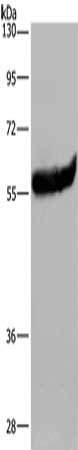 Gel: 8%SDS-PAGE, Lysate: 40 μg, Lane: Mouse brain tissue, Primary antibody: ESR2 Antibody(ESR2 Antibody) at dilution 1/350, Secondary antibody: Goat anti rabbit IgG at 1/8000 dilution, Exposure time: 10 secondsRabbit anti-Human ESR2 Polyclonal Antibody