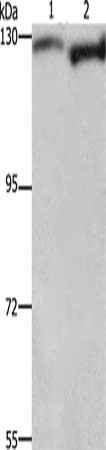 Gel: 6%SDS-PAGE, Lysate: 40 μg, Lane 1-2: Hela cells, 293T cells, Primary antibody: DAAM1 Antibody(DAAM1 Antibody) at dilution 1/350, Secondary antibody: Goat anti rabbit IgG at 1/8000 dilution, Exposure time: 1 minute