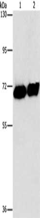 Gel: 15%SDS-PAGE, Lysate: 40 μg, Lane 1-2: HepG2 cells, human placenta tissue, Primary antibody: ALPP Antibody(ALPP Antibody) at dilution 1/1550, Secondary antibody: Goat anti rabbit IgG at 1/8000 dilution, Exposure time: 1 secondRabbit anti-Human ALPP Polyclonal Antibody