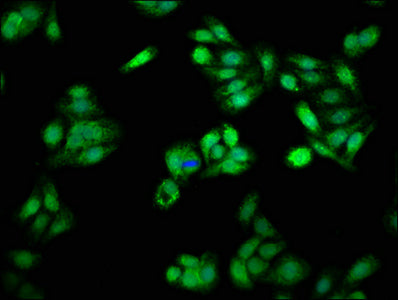 Immunofluorescence staining of HepG2 cells with PSME3 Antibody at 1:66, counter-stained with DAPI. The cells were fixed in 4% formaldehyde, permeabilized using 0.2% Triton X-100 and blocked in 10% normal Goat Serum. The cells were then incubated with the antibody overnight at 4°C. The secondary antibody was Alexa Fluor 488-congugated AffiniPure Goat Anti-Rabbit IgG(H+L).Rabbit anti-Human PSME3 Polyclonal Antibody