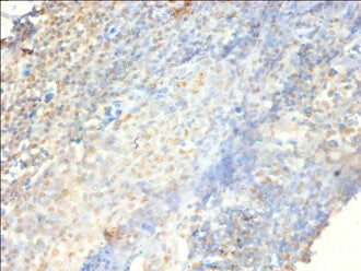 Immunohistochemistry of paraffin-embedded human tonsil tissue using PSME3 Antibody at dilution of 1:100Rabbit anti-Human PSME3 Polyclonal Antibody