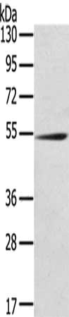 Gel: 8%SDS-PAGE, Lysate: 40 μg, Lane: Mouse kidney tissue, Primary antibody: RMDN3 Antibody(RMDN3 Antibody) at dilution 1/200, Secondary antibody: Goat anti rabbit IgG at 1/8000 dilution, Exposure time: 5 minutesRabbit anti-Human RMDN3 Polyclonal Antibody