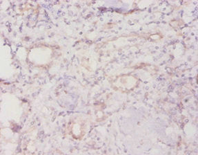 Immunohistochemistry of paraffin-embedded human kidney tissue using TROVE2 Antibody at dilution of 1:20Rabbit anti-Human TROVE2 Polyclonal Antibody
