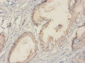 Immunohistochemistry of paraffin-embedded human prostate tissue using TROVE2 Antibody at dilution of 1:20Rabbit anti-Human TROVE2 Polyclonal Antibody