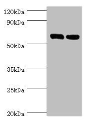 Western blot  | All lanes: TROVE2 antibody at 2µg/ml  | Lane 1: Hela whole cell lysate  | Lane 2: 293T whole cell lysate  | Secondary  | Goat polyclonal to rabbit IgG at 1/10000 dilution  | Predicted band size: 61, 24, 59, 60 kDa  | Observed band size: 61 kDaRabbit anti-Human TROVE2 Polyclonal Antibody