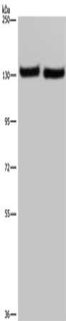 Gel: 6%SDS-PAGE, Lysate: 40 μg, Lane 1-2: A549 cells, human testis tissue, Primary antibody: IPO4 Antibody(IPO4 Antibody) at dilution 1/550, Secondary antibody: Goat anti rabbit IgG at 1/8000 dilution, Exposure time: 40 seconds