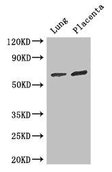 Western Blot | Positive WB detected in: Mouse lung tissue, Human placenta tissue | All lanes: STAU1 antibody at 3μg/ml | Secondary | Goat polyclonal to rabbit IgG at 1/50000 dilution | Predicted band size: 64, 55, 56 kDa | Observed band size: 64 kDaRabbit anti-Human STAU1 Polyclonal Antibody