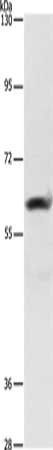Gel: 10%SDS-PAGE, Lysate: 40 μg, Lane: Hela cells, Primary antibody: AIFM3 Antibody(AIFM3 Antibody) at dilution 1/290, Secondary antibody: Goat anti rabbit IgG at 1/8000 dilution, Exposure time: 5 secondsRabbit anti-Human AIFM3 Polyclonal Antibody