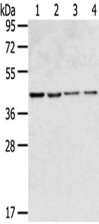 Gel: 8%SDS-PAGE,Lysate: 40 μg,Lane 1-4: HepG2 cells, 231 cells, Hela cells, Lovo cells,Primary antibody: GPR15 Antibody(GPR15 Antibody) at dilution 1/350 dilution,Secondary antibody: Goat anti rabbit IgG at 1/8000 dilution,Exposure time: 20 seconds