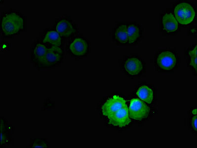 Immunofluorescent analysis of MCF-7 cells using NOX5 Antibody at dilution of 1:100 and Alexa Fluor 488-congugated AffiniPure Goat Anti-Rabbit IgG(H+L)Rabbit anti-Human NOX5 Polyclonal Antibody