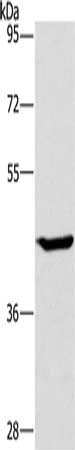 Gel: 8%SDS-PAGE, Lysate: 40 μg, Lane: HT29 cells, Primary antibody: GCK Antibody(GCK Antibody) at dilution 1/450, Secondary antibody: Goat anti rabbit IgG at 1/8000 dilution, Exposure time: 40 secondsRabbit anti-Human GCK Polyclonal Antibody
