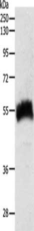 Gel: 10%SDS-PAGE, Lysate: 40 μg, Lane: Human fetal kidney tissue, Primary antibody: SLC22A6 Antibody(SLC22A6 Antibody) at dilution 1/600, Secondary antibody: Goat anti rabbit IgG at 1/8000 dilution, Exposure time: 3 minutesRabbit anti-Human SLC22A6 Polyclonal Antibody