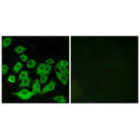 Immunofluorescence analysis of A549 cells, using RPL36 antibody.Rabbit anti-Human RPL36 Polyclonal Antibody