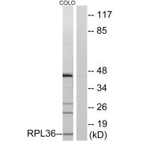 Western blot analysis of extracts from COLO cells, using RPL36 antibody.Rabbit anti-Human RPL36 Polyclonal Antibody