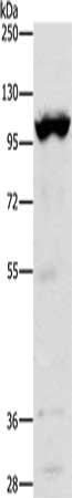 Gel: 10%SDS-PAGE, Lysate: 40 μg, Lane: Mouse heart tissue, Primary antibody: TRPM5 Antibody(TRPM5 Antibody) at dilution 1/1200, Secondary antibody: Goat anti rabbit IgG at 1/8000 dilution, Exposure time: 20 secondsRabbit anti-Human TRPM5 Polyclonal Antibody