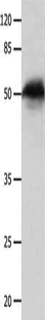 Gel: 10%SDS-PAGE, Lysate: 40 μg, Lane: Mouse liver tissue, Primary antibody: P2RY11 Antibody(P2RY11 Antibody) at dilution 1/450, Secondary antibody: Goat anti rabbit IgG at 1/8000 dilution, Exposure time: 1 minuteRabbit anti-Human P2RY11 Polyclonal Antibody