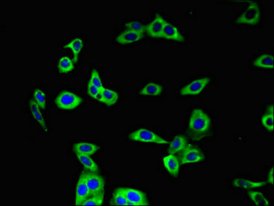 Immunofluorescent analysis of HepG2 cells using AQP3 Antibody at dilution of 1:100 and Alexa Fluor 488-congugated AffiniPure Goat Anti-Rabbit IgG(H+L)Rabbit anti-Human AQP3 Polyclonal Antibody