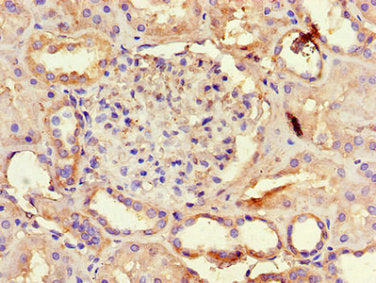 Immunohistochemistry of paraffin-embedded human kidney tissue using the antibody at dilution of 1:100Rabbit anti-Human AQP3 Polyclonal Antibody