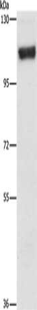 Gel: 6%SDS-PAGE, Lysate: 40 μg, Lane: 293T cells, Primary antibody: PRKD1 Antibody(PRKD1 Antibody) at dilution 1/250, Secondary antibody: Goat anti rabbit IgG at 1/8000 dilution, Exposure time: 10 minutesRabbit anti-Human PRKD1 Polyclonal Antibody