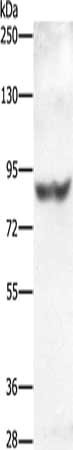 Gel: 10%SDS-PAGE, Lysate: 40 μg, Lane: HT29 cells, Primary antibody: ABCG1 Antibody(ABCG1 Antibody) at dilution 1/300, Secondary antibody: Goat anti rabbit IgG at 1/8000 dilution, Exposure time: 40 seconds