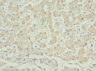 Immunohistochemistry of paraffin-embedded human liver tissue using INHBB Antibody at dilution of 1:100