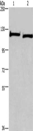 Gel: 6%SDS-PAGE, Lysate: 40 μg, Lane 1-2: Human fetal brain tissue, Hela cells, Primary antibody: IPO9 Antibody(IPO9 Antibody) at dilution 1/200, Secondary antibody: Goat anti rabbit IgG at 1/8000 dilution, Exposure time: 1 minute