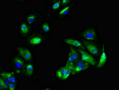 Immunofluorescent analysis of HepG2 cells using KRAS Antibody at dilution of 1:100 and Alexa Fluor 488-congugated AffiniPure Goat Anti-Rabbit IgG(H+L)