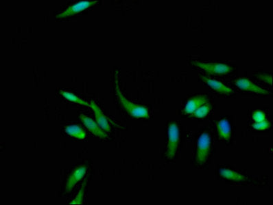 Immunofluorescence staining of Hela cells with KRAS Antibody at 1:133, counter-stained with DAPI. The cells were fixed in 4% formaldehyde, permeabilized using 0.2% Triton X-100 and blocked in 10% normal Goat Serum. The cells were then incubated with the antibody overnight at 4°C. The secondary antibody was Alexa Fluor 488-congugated AffiniPure Goat Anti-Rabbit IgG(H+L).