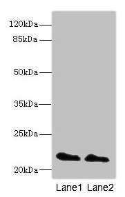 Western blot  | All lanes: KRAS antibody at 2µg/ml  | Lane 1: Mouse brain tissue  | Lane 2: Mouse kidney tissue  | Secondary  | Goat polyclonal to rabbit IgG at 1/10000 dilution  | Predicted band size: 22 kDa  | Observed band size: 22 kDa