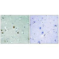 Immunohistochemistry analysis of paraffin-embedded human brain tissue using CRMP-2 (Ab-509) antibody.Rabbit anti-Human DPYSL2 Polyclonal Antibody