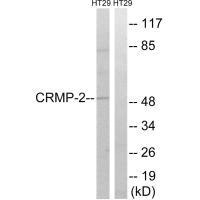 Western blot analysis of extracts from HT-29 cells, treated with heat shock, using CRMP-2 (Ab-509) antibody.Rabbit anti-Human DPYSL2 Polyclonal Antibody