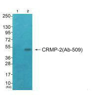Western blot analysis of extracts from COS7 cells (Lane 2), using CRMP-2 (Ab-509) antiobdy. The lane on the left is treated with systhesized peptide.Rabbit anti-Human DPYSL2 Polyclonal Antibody