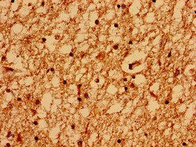 Immunohistochemistry of paraffin-embedded human brain tissue using GRIN2A Antibody at dilution of 1:100Rabbit anti-Human GRIN2A Polyclonal Antibody