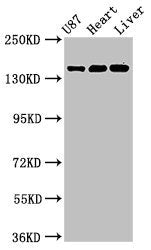 Western Blot  | Positive WB detected in: U87 whole cell lysate, Rat heart tissue, Mouse liver tissue  | All lanes: GRIN2A antibody at 3.2µg/ml  | Secondary  | Goat polyclonal to rabbit IgG at 1/50000 dilution  | Predicted band size: 166, 145 kDa  | Observed band size: 166 kDaRabbit anti-Human GRIN2A Polyclonal Antibody
