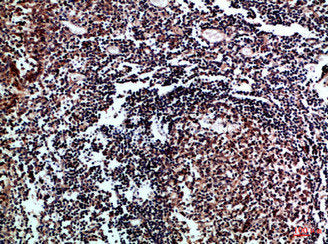 Immunohistochemical analysis of paraffin-embedded Human-tonsil, antibody was diluted at 1:100Rabbit anti-Human IL17D Polyclonal Antibody