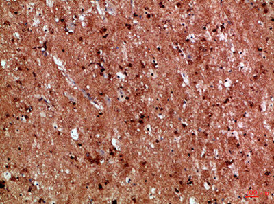 Immunohistochemical analysis of paraffin-embedded Human-brain, antibody was diluted at 1:100Rabbit anti-Human IL17D Polyclonal Antibody