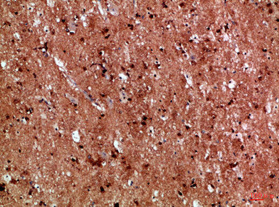 Immunohistochemical analysis of paraffin-embedded Human-brain, antibody was diluted at 1:100Rabbit anti-Human IL17D Polyclonal Antibody