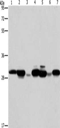 Gel: 10%SDS-PAGE, Lysate: 40 μg, Lane 1-7: Human placenta tissue, A549 cells, mouse brain tissue, hepG2 cells, Raji cells, human fetal liver tissue, hela cells, Primary antibody: AK2 Antibody(AK2 Antibody) at dilution 1/250, Secondary antibody: Goat anti rabbit IgG at 1/8000 dilution, Exposure time: 20 secondsRabbit anti-Human AK2 Polyclonal Antibody