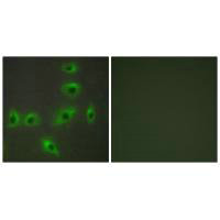Immunofluorescence analysis of HUVEC cells, using BAX antibody.