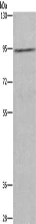 Gel: 6%SDS-PAGE, Lysate: 40 μg, Lane: Human testis tissue, Primary antibody: MUC15 Antibody(MUC15 Antibody) at dilution 1/200, Secondary antibody: Goat anti rabbit IgG at 1/8000 dilution, Exposure time: 10 secondsRabbit anti-Human MUC15 Polyclonal Antibody