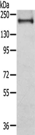 Gel: 6%SDS-PAGE,Lysate: 40 μg,,Primary antibody: IQGAP2 Antibody(IQGAP2 Antibody) at dilution 1/350 dilution,Secondary antibody: Goat anti rabbit IgG at 1/8000 dilution,Exposure time: 20 seconds