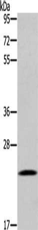 Gel: 8%SDS-PAGE, Lysate: 40 μg, Lane: Human testis tissue, Primary antibody: UBE2S Antibody(UBE2S Antibody) at dilution 1/300, Secondary antibody: Goat anti rabbit IgG at 1/8000 dilution, Exposure time: 2 minutesRabbit anti-Human UBE2S Polyclonal Antibody