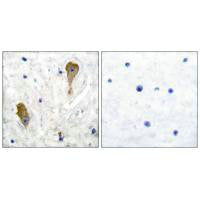 Immunohistochemical analysis of paraffin-embedded human brain tissue using GAD67 antibody.Rabbit anti-Human GAD1 Polyclonal Antibody