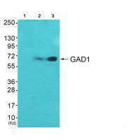 Western blot analysis of extracts from  A549 cells (Lane 2) and HepG2 cells (Lane 3), using GAD67 antiobdy. The lane on the left is treated with systhesized peptide.Rabbit anti-Human GAD1 Polyclonal Antibody