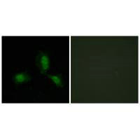 Immunofluorescence analysis of HeLa cells, using IRS-1 (Ab-312) antibody.