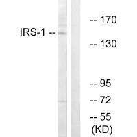 Western blot analysis of extracts from NIH-3T3 cells, using IRS-1 (Ab-312) antibody.
