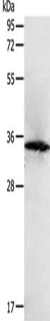 Gel: 12%SDS-PAGE, Lysate: 40 μg, Lane: MCF7 cells, Primary antibody: SIRT4 Antibody(SIRT4 Antibody) at dilution 1/400, Secondary antibody: Goat anti rabbit IgG at 1/8000 dilution, Exposure time: 1 minuteRabbit anti-Human SIRT4 Polyclonal Antibody